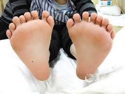 feet with 8 toes